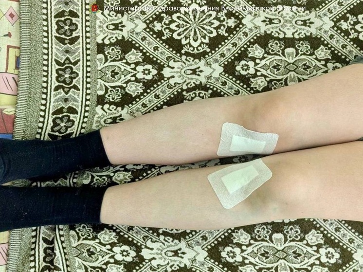 Владимирские врачи исправили х-образную деформацию ног подростку