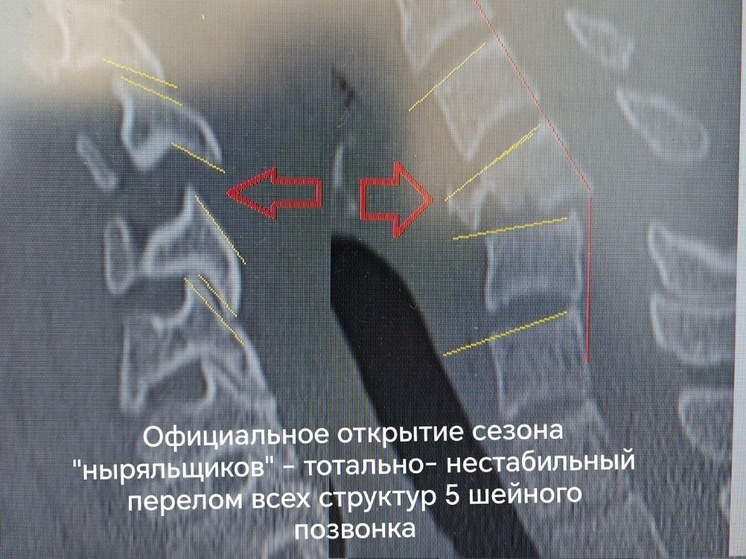 Два красноярца получили серьезные травмы после купания