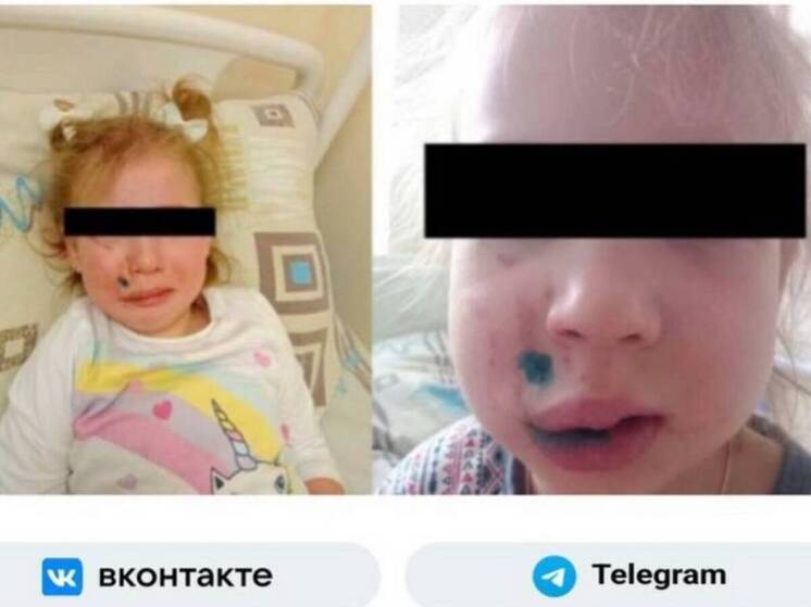 С хозяйки кане-корсо требует полмиллиона за нападение на ребенка в Брянске