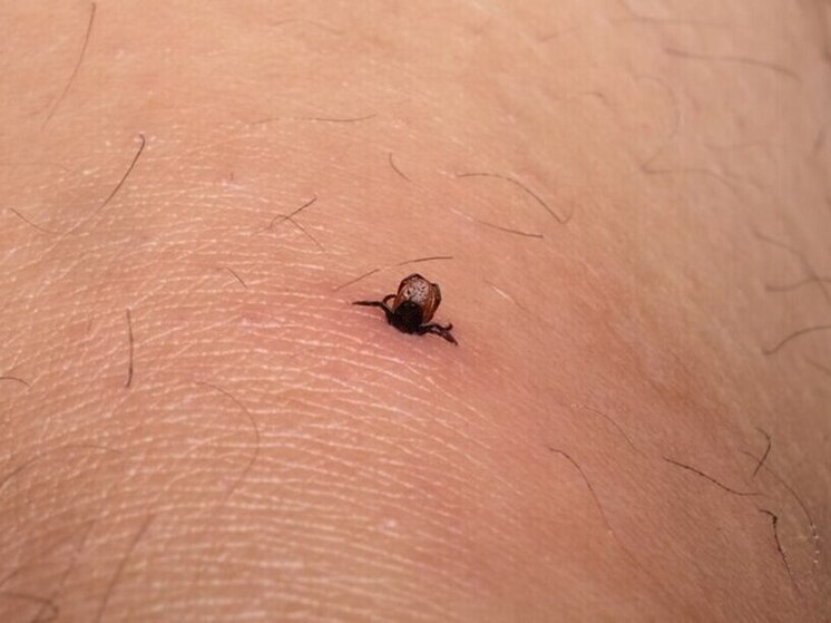 Триста калужан пожаловались на укусы клещей