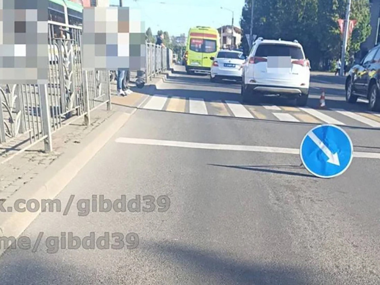 Калининградец на самокате попал под колёса иномарки