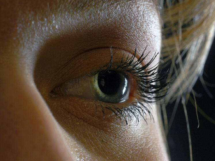 Томичка привезла из отпуска паразита, который жил у нее под кожей глаза