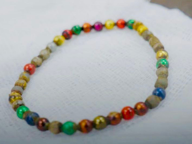 Мальчик ел магнитные шарики целый месяц