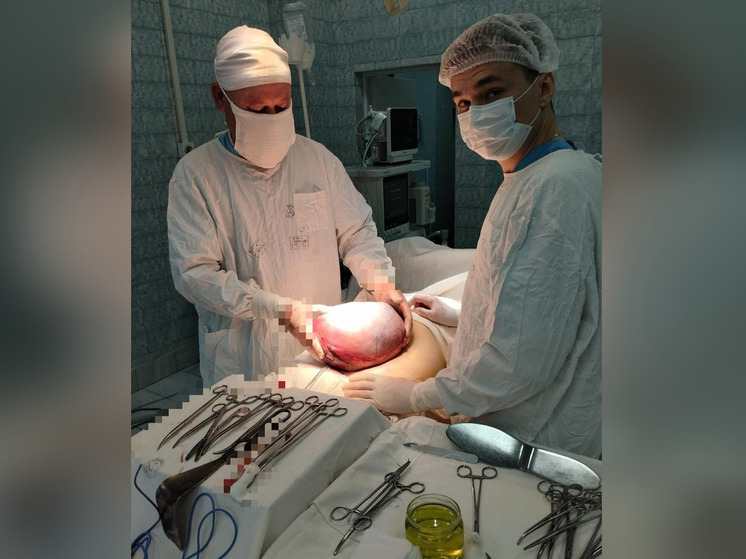 В Башкирии 78-летней пенсионерке удалили гигантскую опухоль