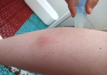 Лето – это пора не только отдыха, прогулок по парку и свежих фруктов и овощей, но и насекомых, которые являются переносчиками многих опасных заболеваний