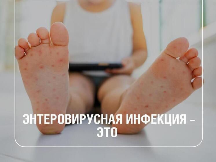 Как распознать энтеровирусные инфекции: симптомы, профилактика и меры предосторожности