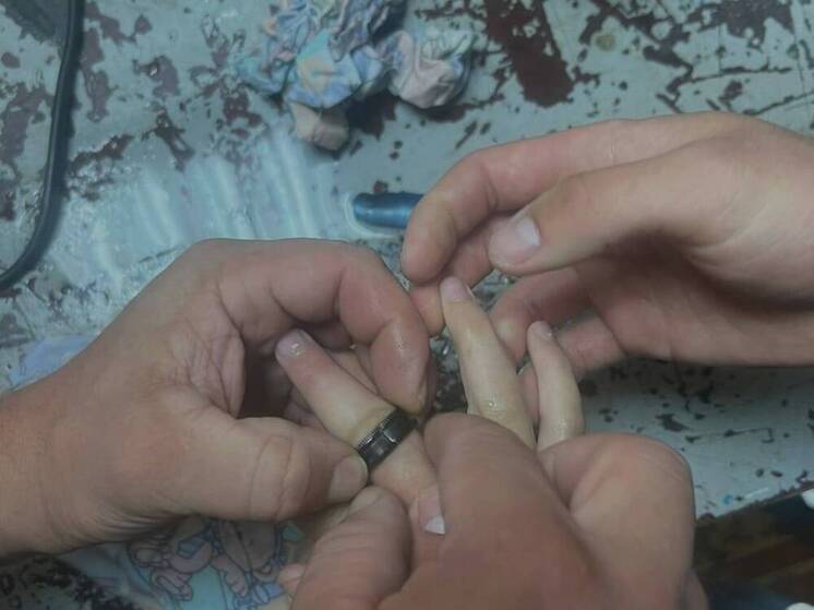 Спасатели в Казани помогли девочке снять кольцо с опухшего пальца