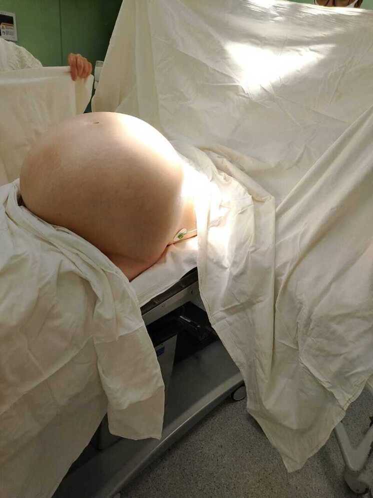 Калужские врачи провели уникальную операцию