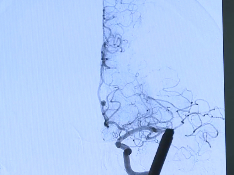 Смоленская область присоединилась к Неделе сохранения здоровья головного мозга