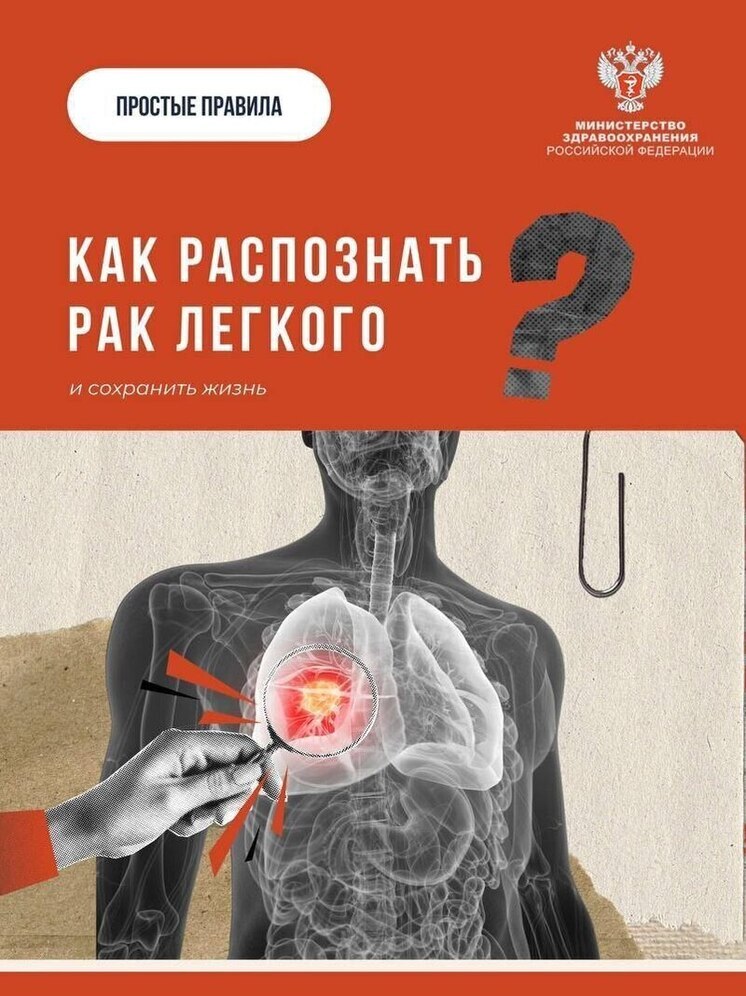 Псоквичам рассказали, как распознать рак легкого на ранней стадии