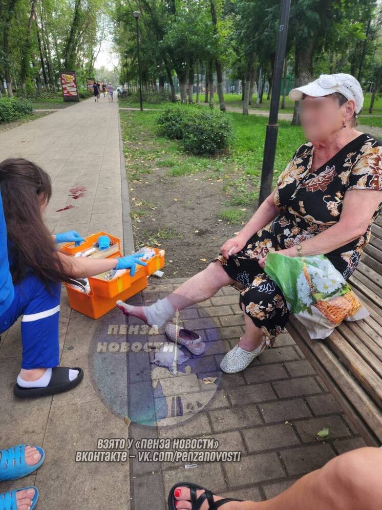 В пензенском Детском парке собака напала на пожилую женщину