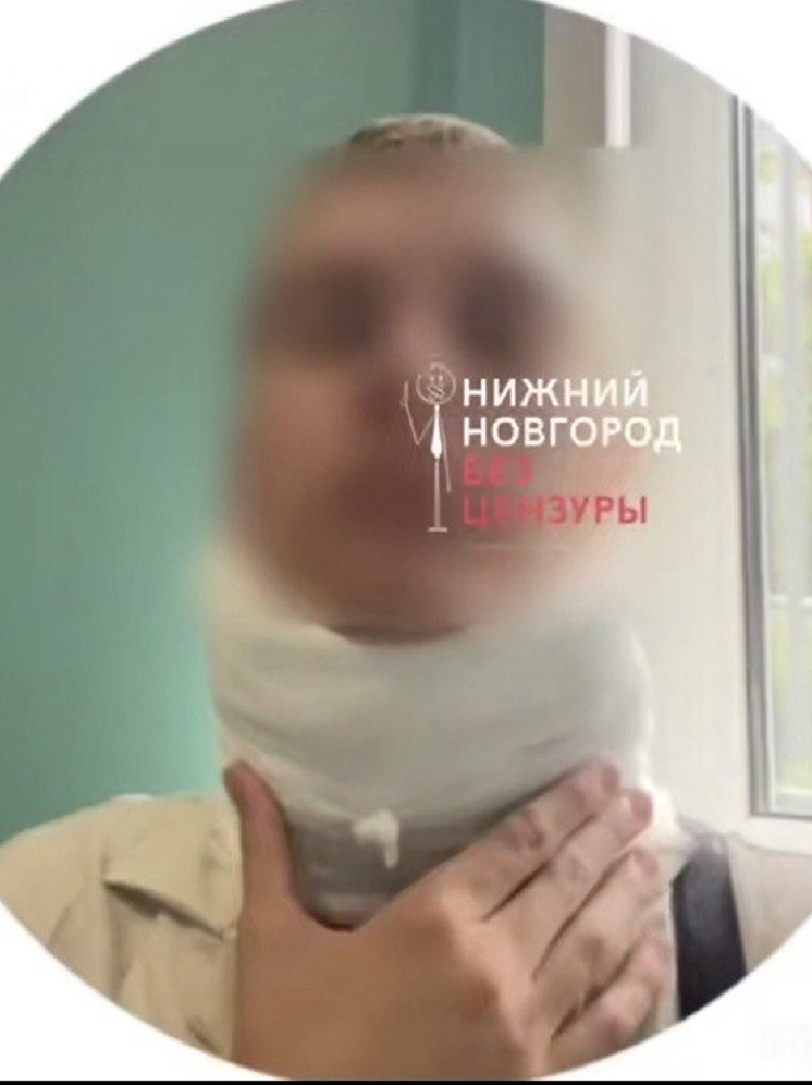 Охранник нижегородского парка «Швейцария» жестоко избил посетителя
