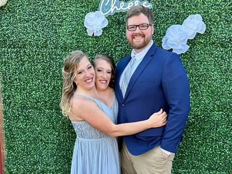 Девушки – сиамские близнецы родили ребенка