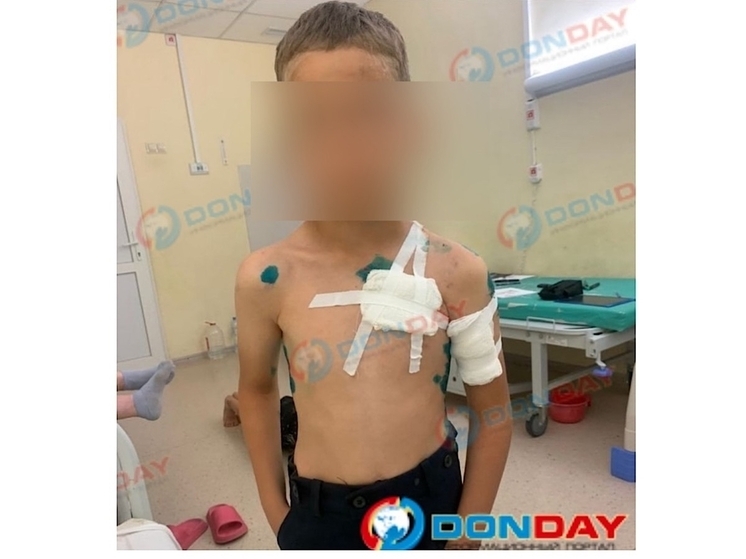 В Ростовской области волка, напавшего на 8-летнего мальчика, усыпили