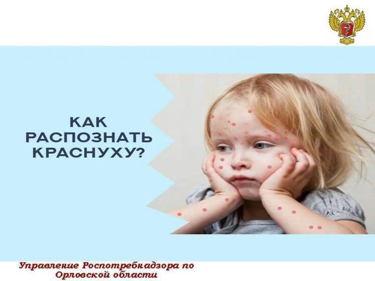 В Орловской области проведут мероприятия по подчищающей иммунизации против краснухи