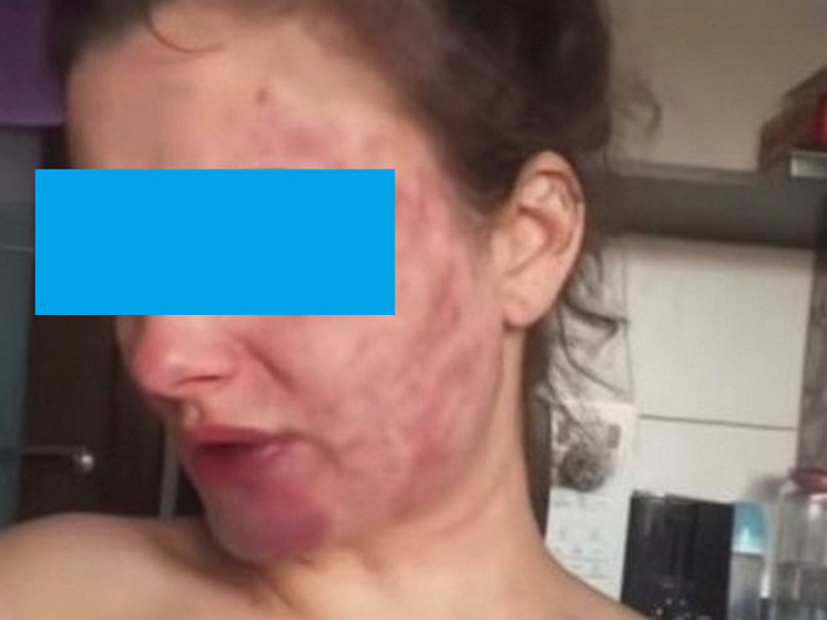 В Калининграде многодетную мать жестко избил бывший муж