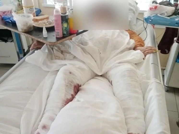 Астраханка, едва не погибшая в горячей воде, обратилась в суд