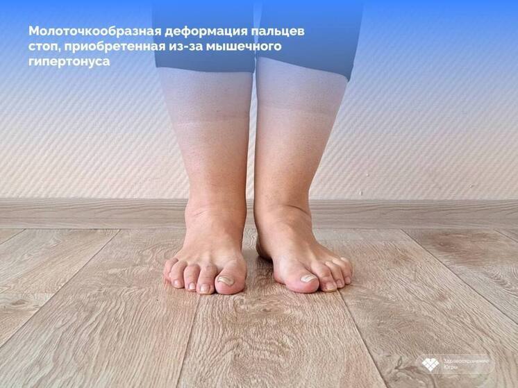 Сургутские врачи поставили редкий диагноз с первого обращения