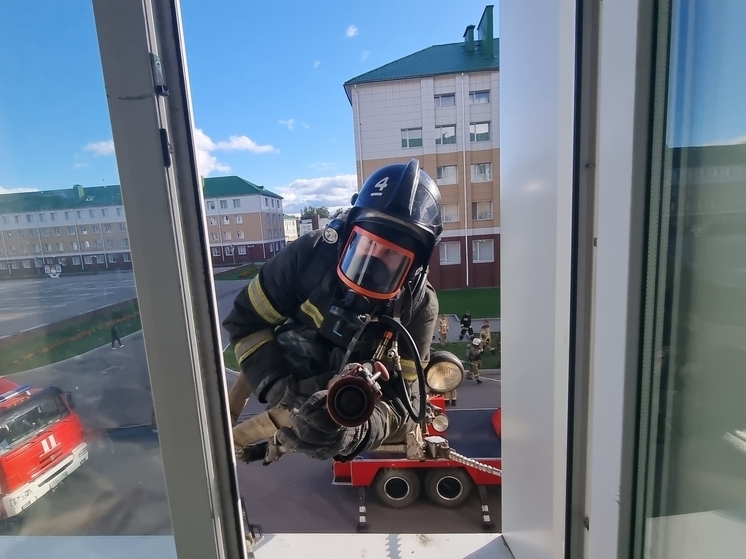 В Костроме пожилая женщина случайно спалила себе лицо