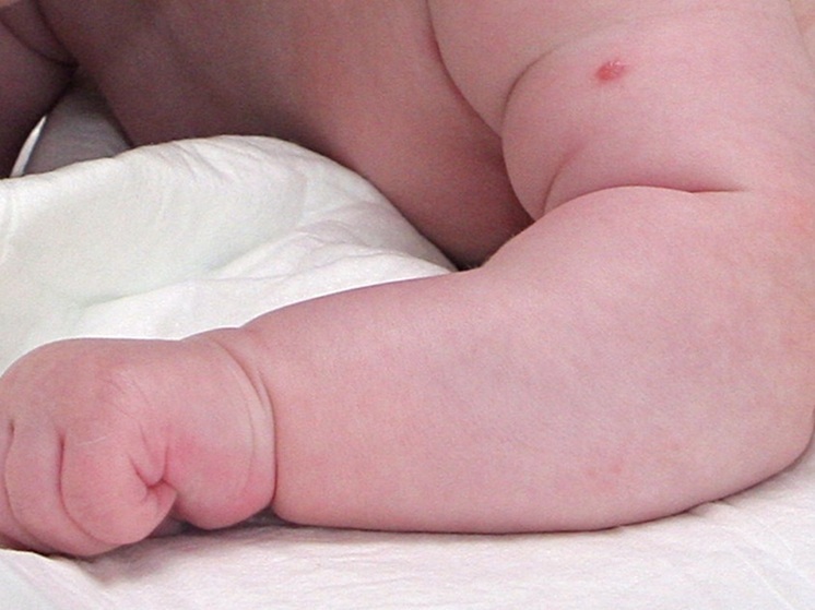 В Бразилии младенец появился на свет с контрацептивом в руках