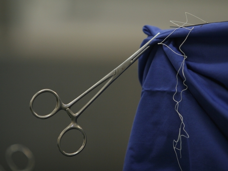 У девочки в желчном пузыре нашли множество камней