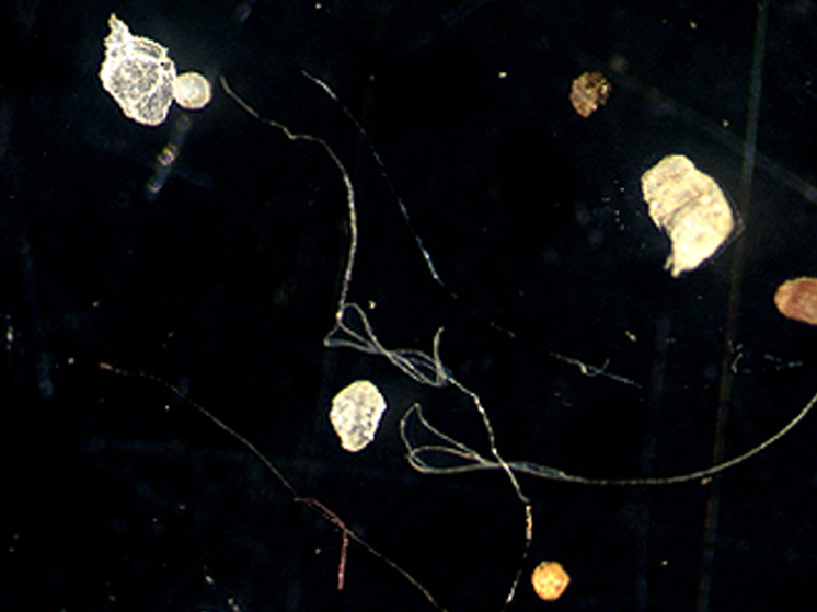 Las partículas de plástico alteran el equilibrio de la microflora intestinal