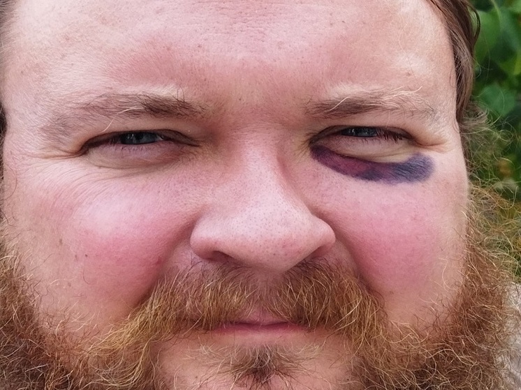 Священник из Рязани Дмитрий Фетисов стал жертвой нападения хулиганов