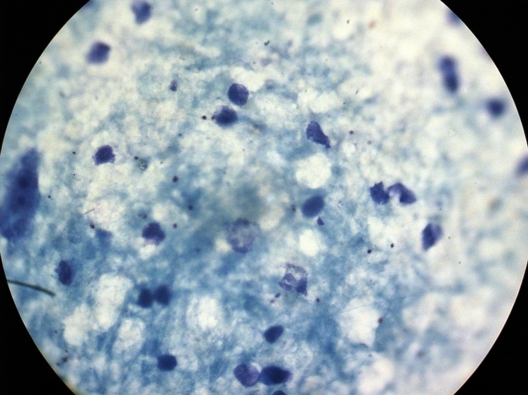 Австралийские ученые выявили угрозу супербактерий для младенцев