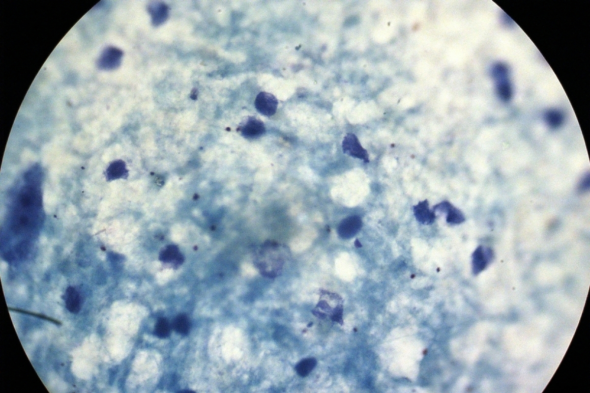 Австралийские ученые выявили угрозу супербактерий для младенцев