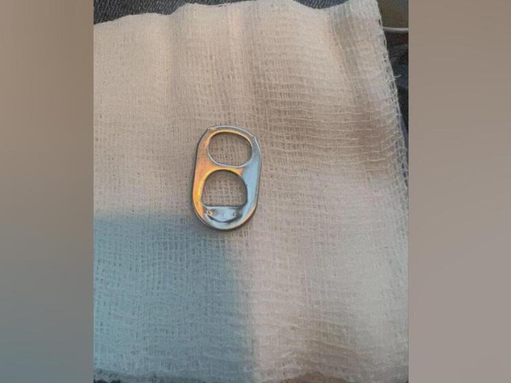 В Подмосковье спасли малыша, проглотившего ключ от металлической банки