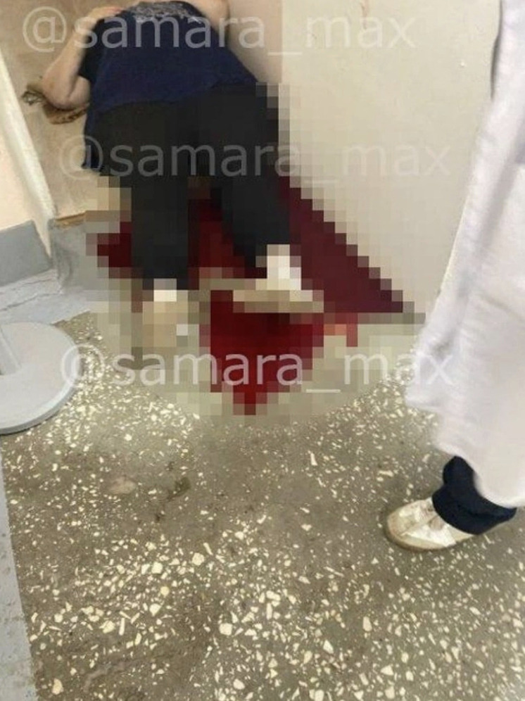 В общежитии самарского колледжа женщина упала после операции, крови много