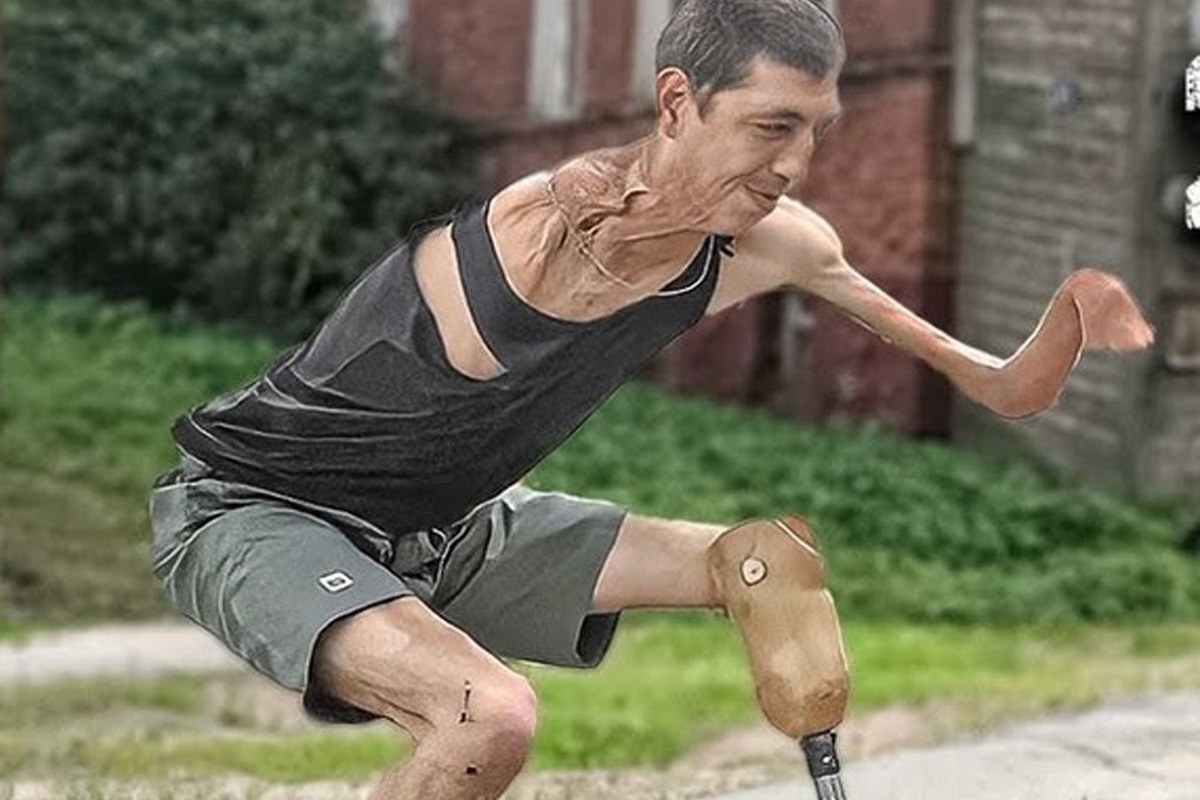 ФСИН отреагировала на содержащегося в колонии инвалида без рук, ноги и уха