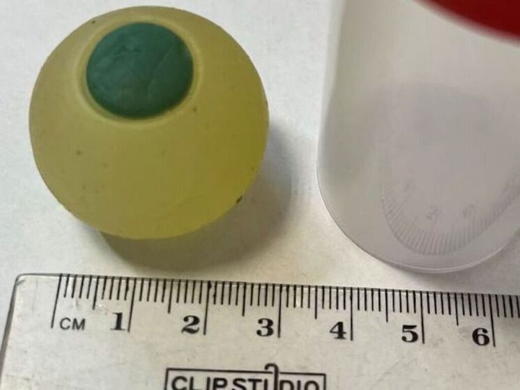 Силиконовый глаз застрял в кишечнике девятилетнего жителя Челябинска