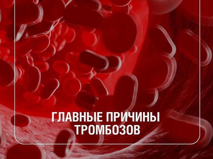 Внимание, тромбоз! Эксперты назвали главные факторы риска и способы профилактики
