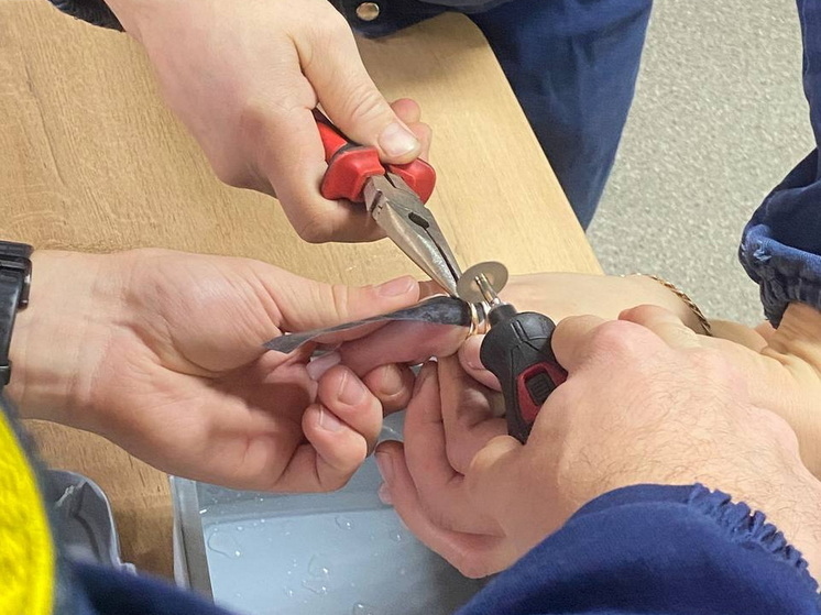 Спасатели помогли жительнице Марий Эл снять тесное кольцо