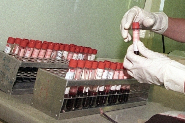 Рост заболеваемости ВИЧ отмечен в трех регионах России