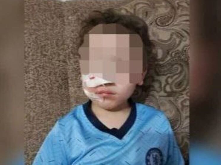 Ребенок, пострадавший от укуса собаки в Яранске, получит 100 000 рублей