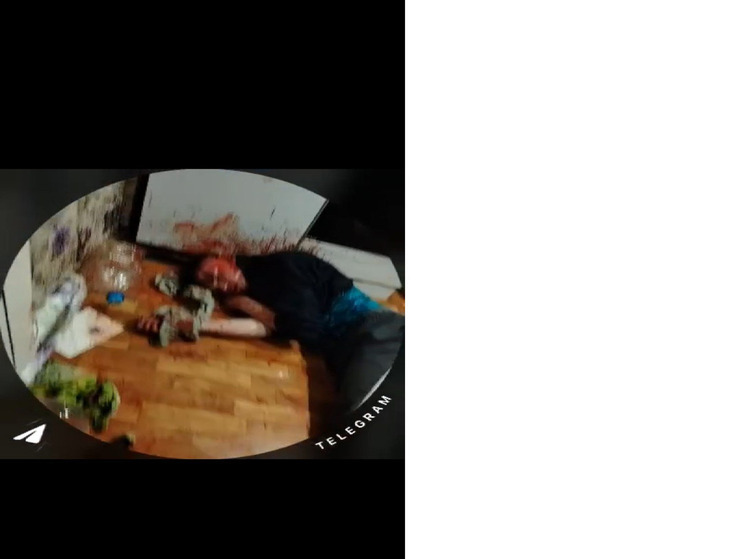 Пострадавший 22-летний инвалид из Беломорска, которого жестоко избил подросток, скончался сегодня утром