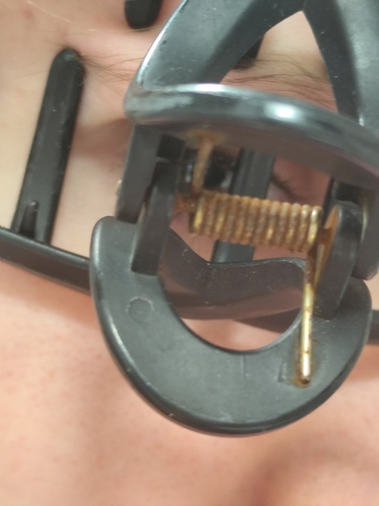 Калужане могут не бояться лайфхака от мигрени из соцсетей