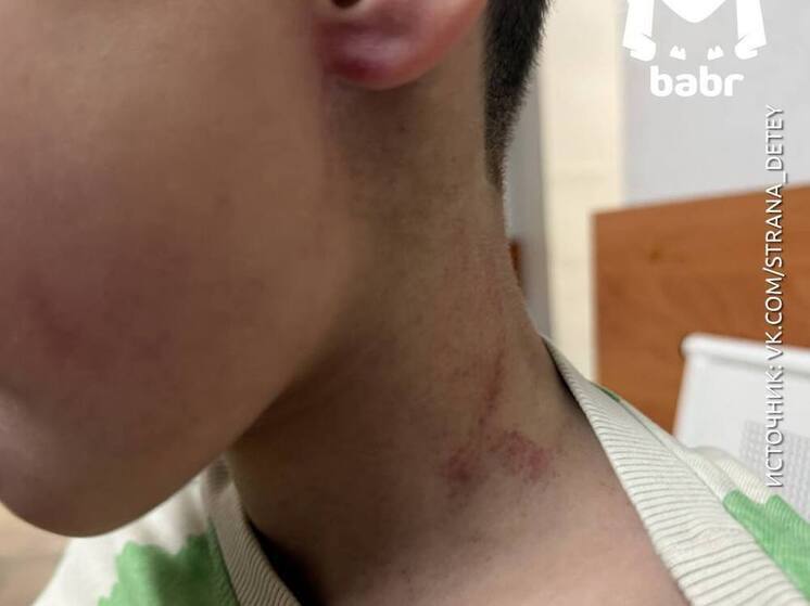 В Иркутском округе тренер по физкультуре нанёс травмы ребёнку