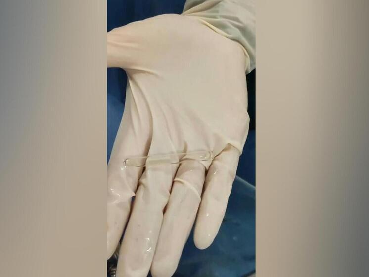 Врачи обнаружили пипетку в мочевом пузыре мужчины