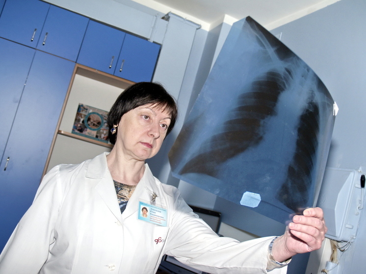 В РФ на 100 тысяч населения приходится 629 случаев внебольничной пневмонии