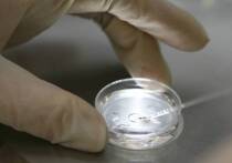 Ученые утверждают, что вирус Эпштейна-Барр (ВЭБ), по-видимому, вызывает волчанку