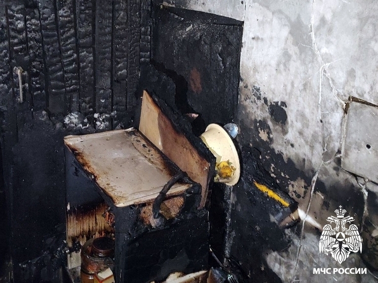 Мужчина получил травмы во время пожара в Череповце