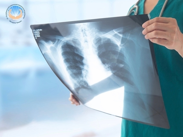 День открытых дверей для мужчин пройдёт 22 ноября в онкодиспансере Чувашии