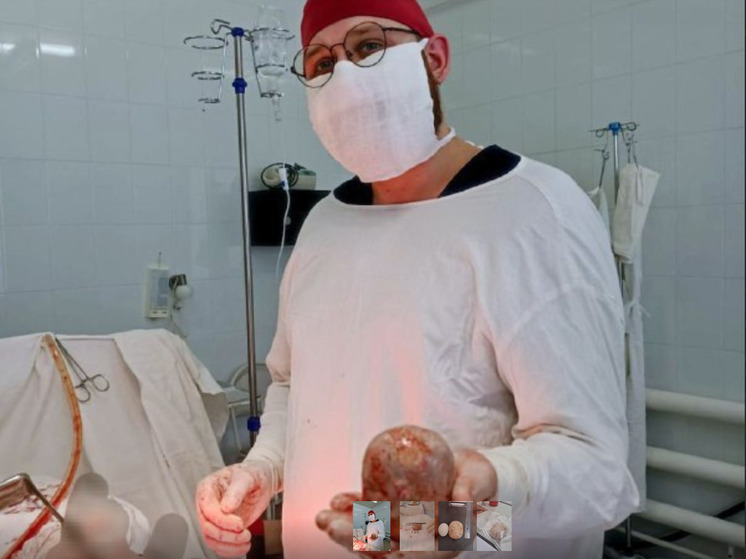 У балаковца в мочевом пузыре нашли килограммовый камень