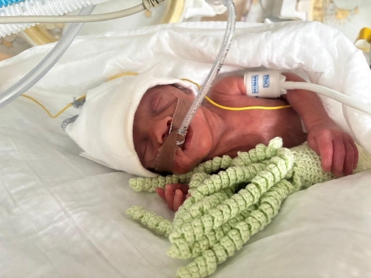 В Иванове выходили малыша весом 491 грамм