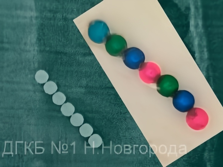 Врачи спасли 2-летнего нижегородца, наглотавшегося магнитных шариков