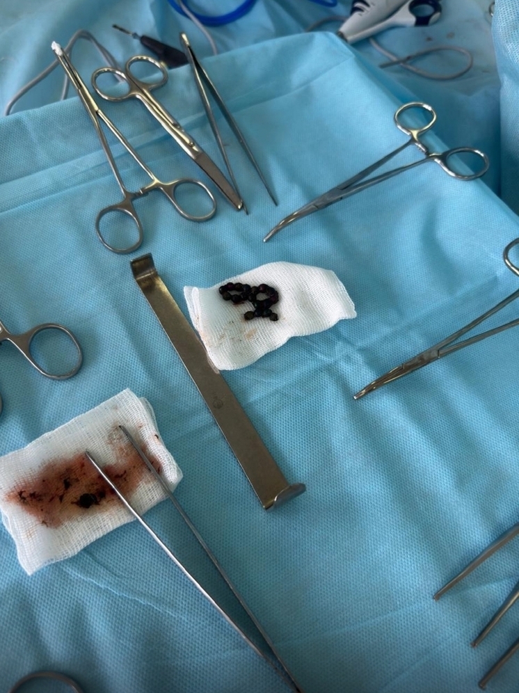 Медики Ставрополя спасли трехлетнего малыша, который проглотил 18 магнитов