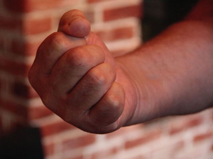 В Советске подростка избили ножкой от табуретки